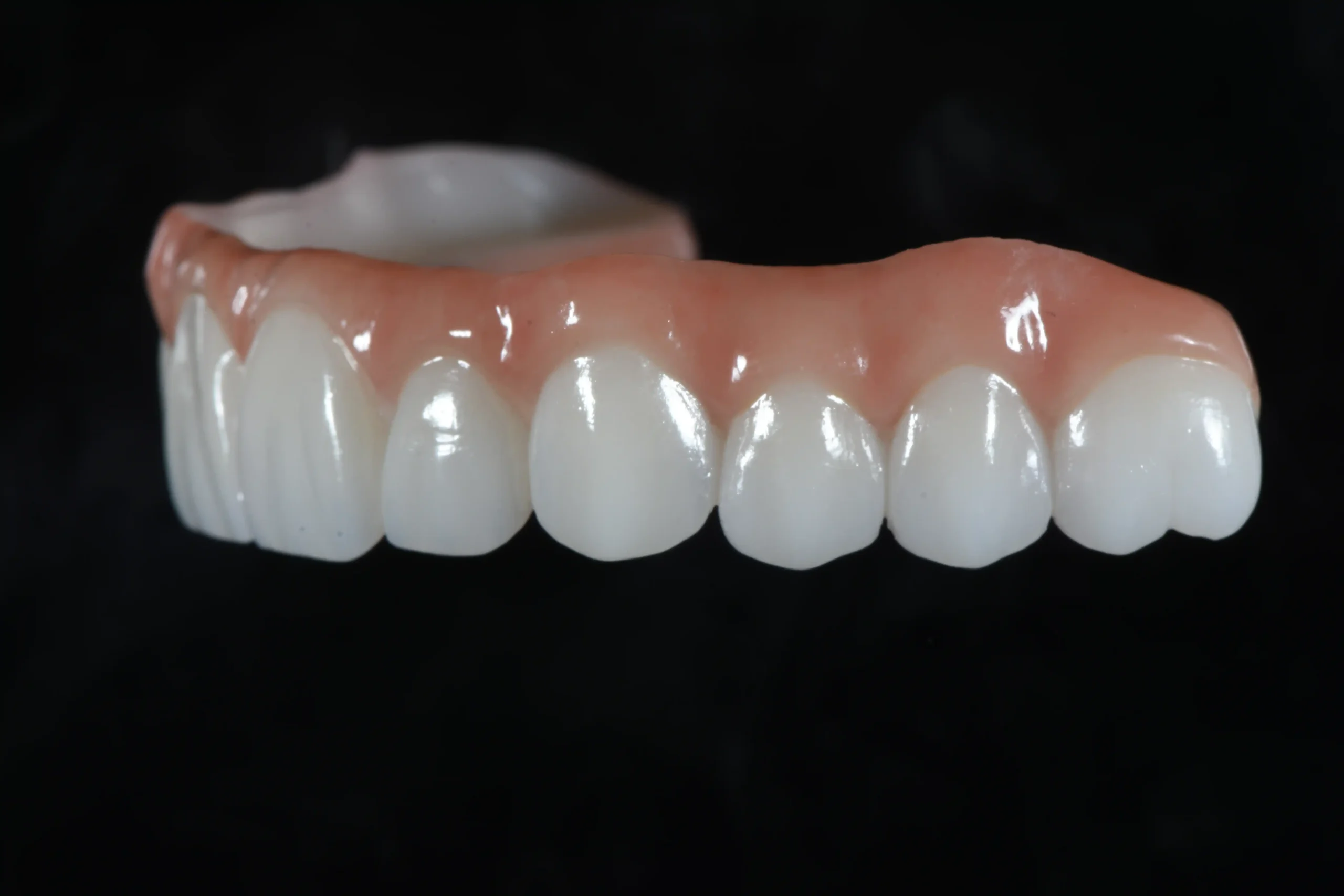 About Us 6 All-on-X Full-Arch Dental Implants (All-on-468) B2B Dental Lab