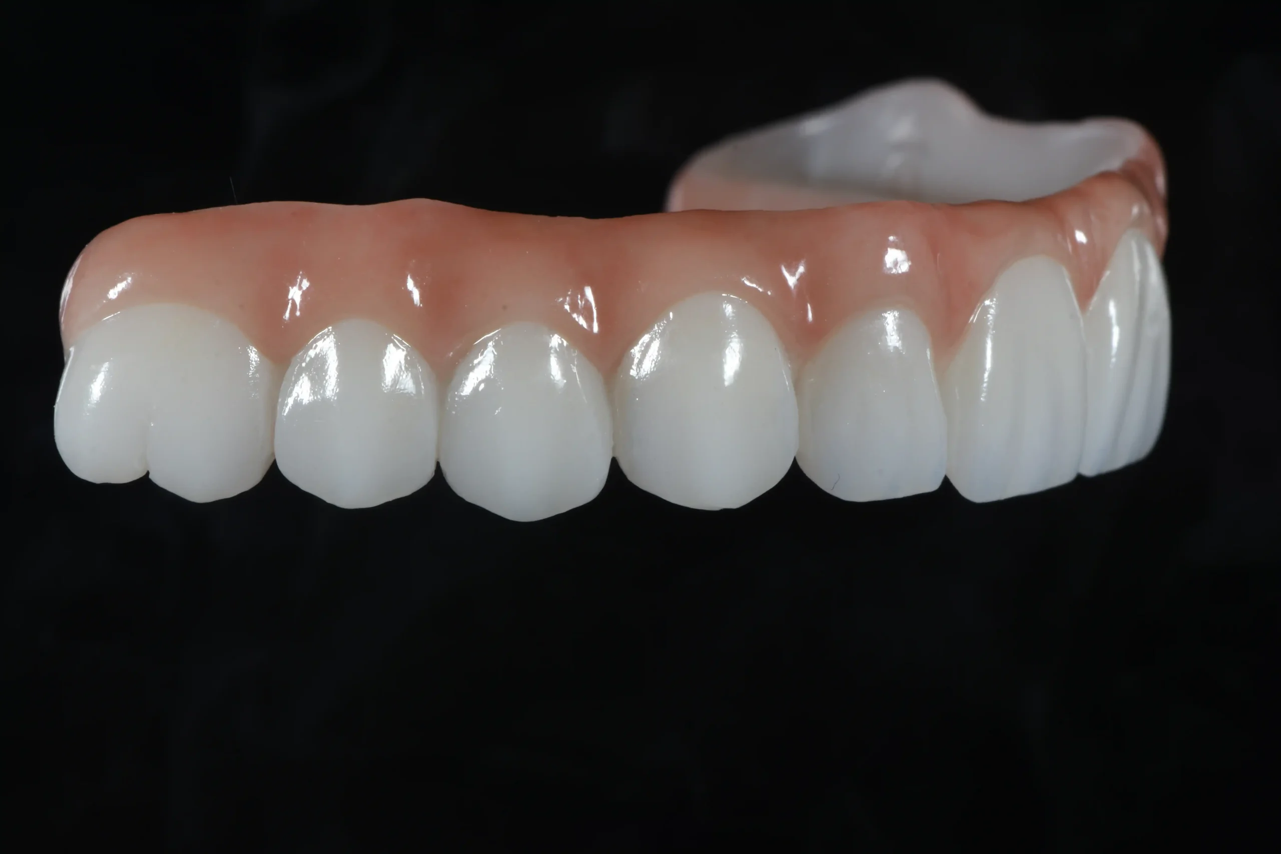 About Us 7 All-on-X Full-Arch Dental Implants (All-on-468) B2B Dental Lab