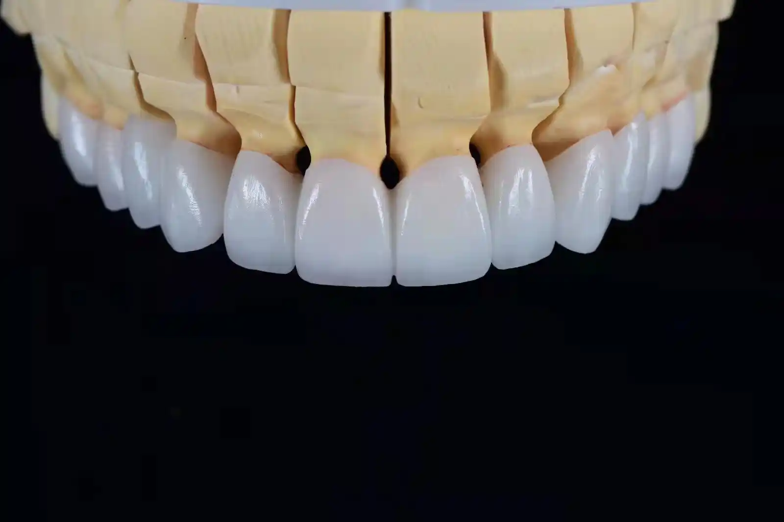 About Us 9 Full Contour Multi Layer Zirconia Crowns & Bridges China Dental Lab