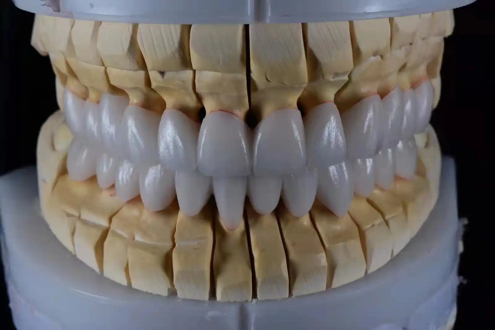 About Us 8 Hand-Layered Zirconia Crowns & Bridges China Dental Lab