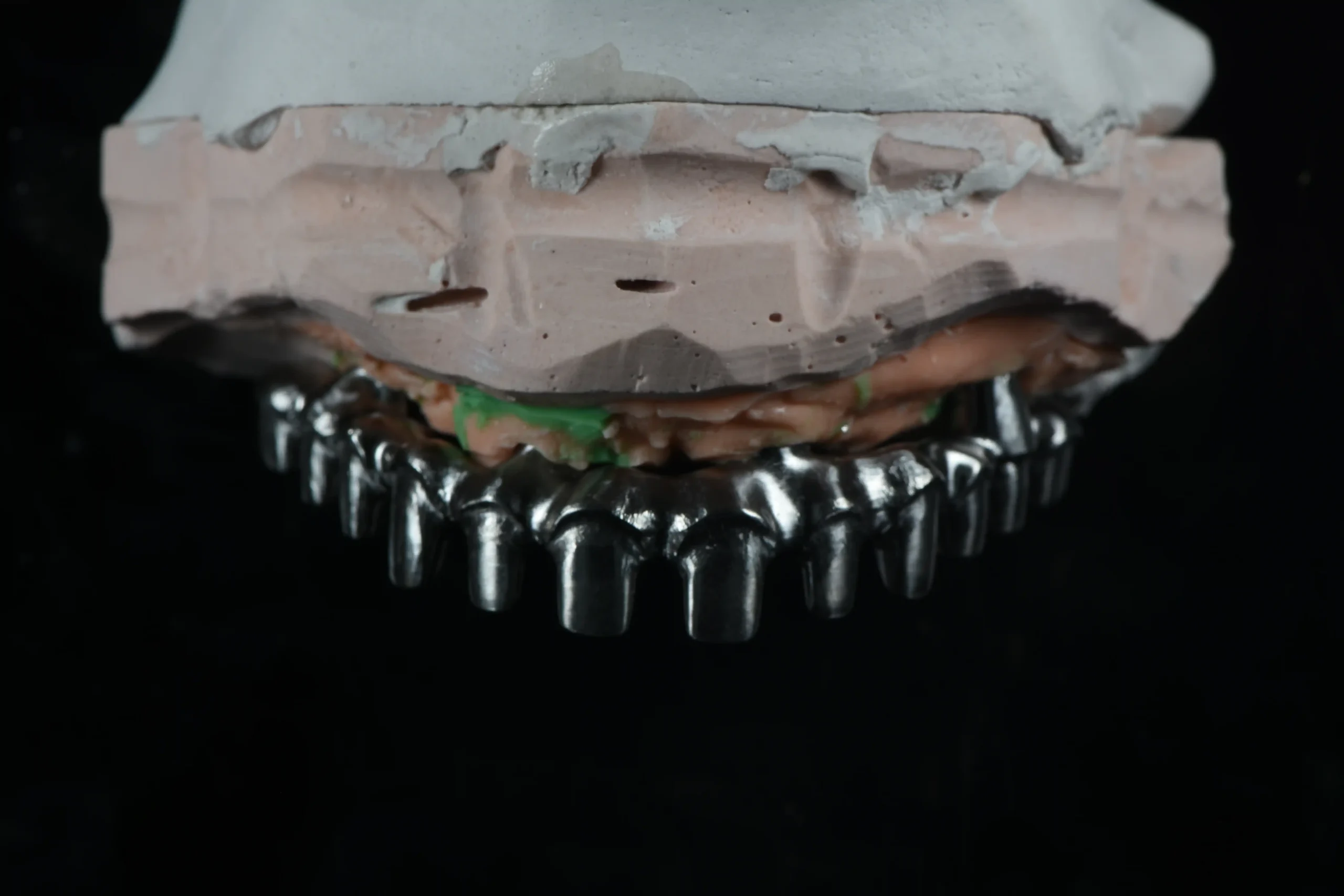 About Us 4 Malo Protocol Full-Arch Bridge (All-on-46) China Dental Lab B2B