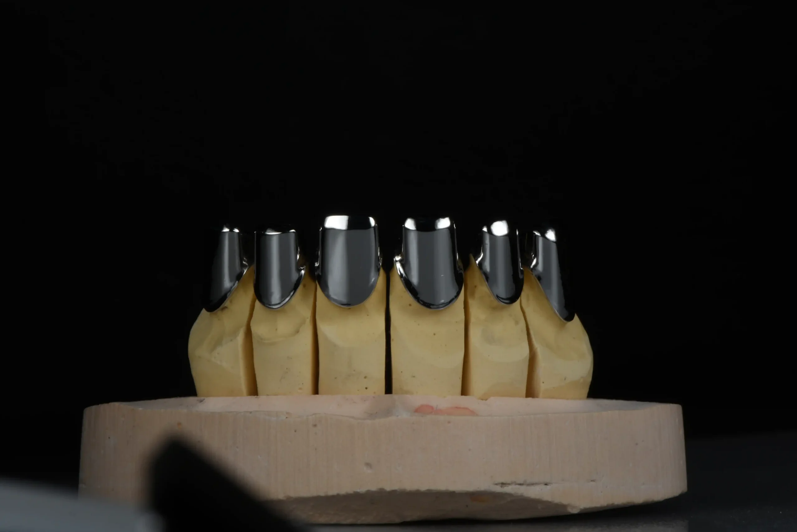 About Us 3 Telescopic Crown System (Double Crown Denture) China Dental Laboratory