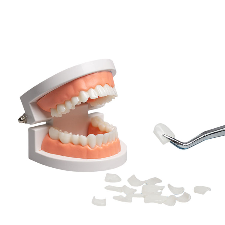 Can Layered E.max Veneers Truly Replace Feldspathic Veneers