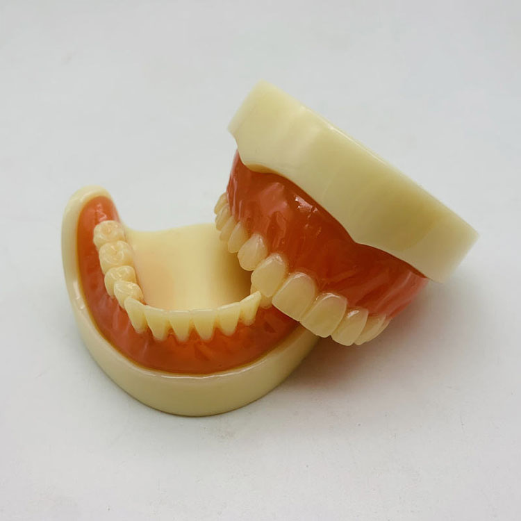 How Should Anterior and Posterior Materials Be Coordinated in Full-Mouth Rehabilitation? 2 How Should Anterior and Posterior Materials Be Coordinated in Full-Mouth Rehabilitation