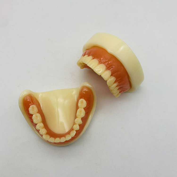 How Should Anterior and Posterior Materials Be Coordinated in Full-Mouth Rehabilitation? 3 How Should Anterior and Posterior Materials Be Coordinated in Full-Mouth Rehabilitation