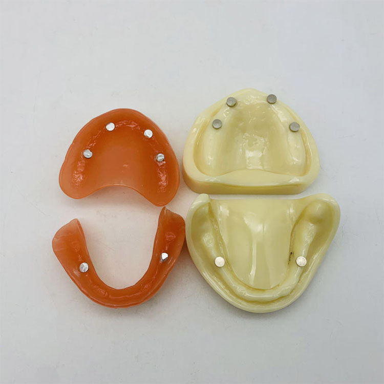 How Should Anterior and Posterior Materials Be Coordinated in Full-Mouth Rehabilitation? 1 How Should Anterior and Posterior Materials Be Coordinated in Full-Mouth Rehabilitation