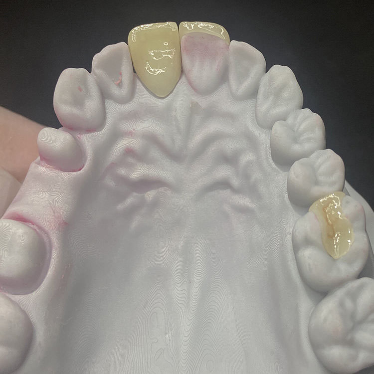 How Should Minimum Reduction for E.max Crowns Be Communicated to Buyers? 1 How Should Minimum Reduction for E.max Crowns Be Communicated to Buyers