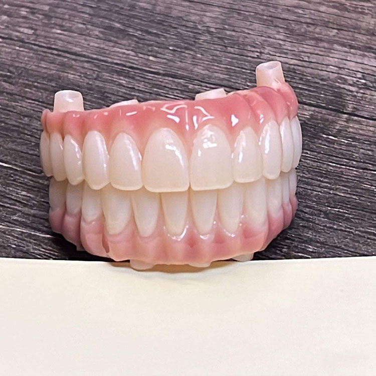 How Surface Treatment Differs Between E.max and Zirconia 1 How Surface Treatment Differs Between E.max and Zirconia