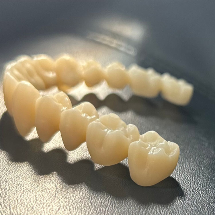 How Surface Treatment Differs Between E.max and Zirconia 3 How Surface Treatment Differs Between E.max and Zirconia