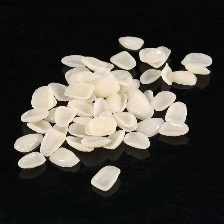 How to Build a More Predictable Veneer Plan for Tetracycline-Stained Teeth 2 How to Build a More Predictable Veneer Plan for Tetracycline Stained Teeth 1