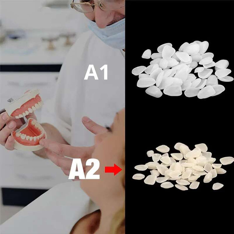 How to Build a More Predictable Veneer Plan for Tetracycline-Stained Teeth 1 How to Build a More Predictable Veneer Plan for Tetracycline Stained Teeth 2