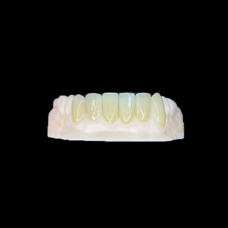 Multi-Veneer