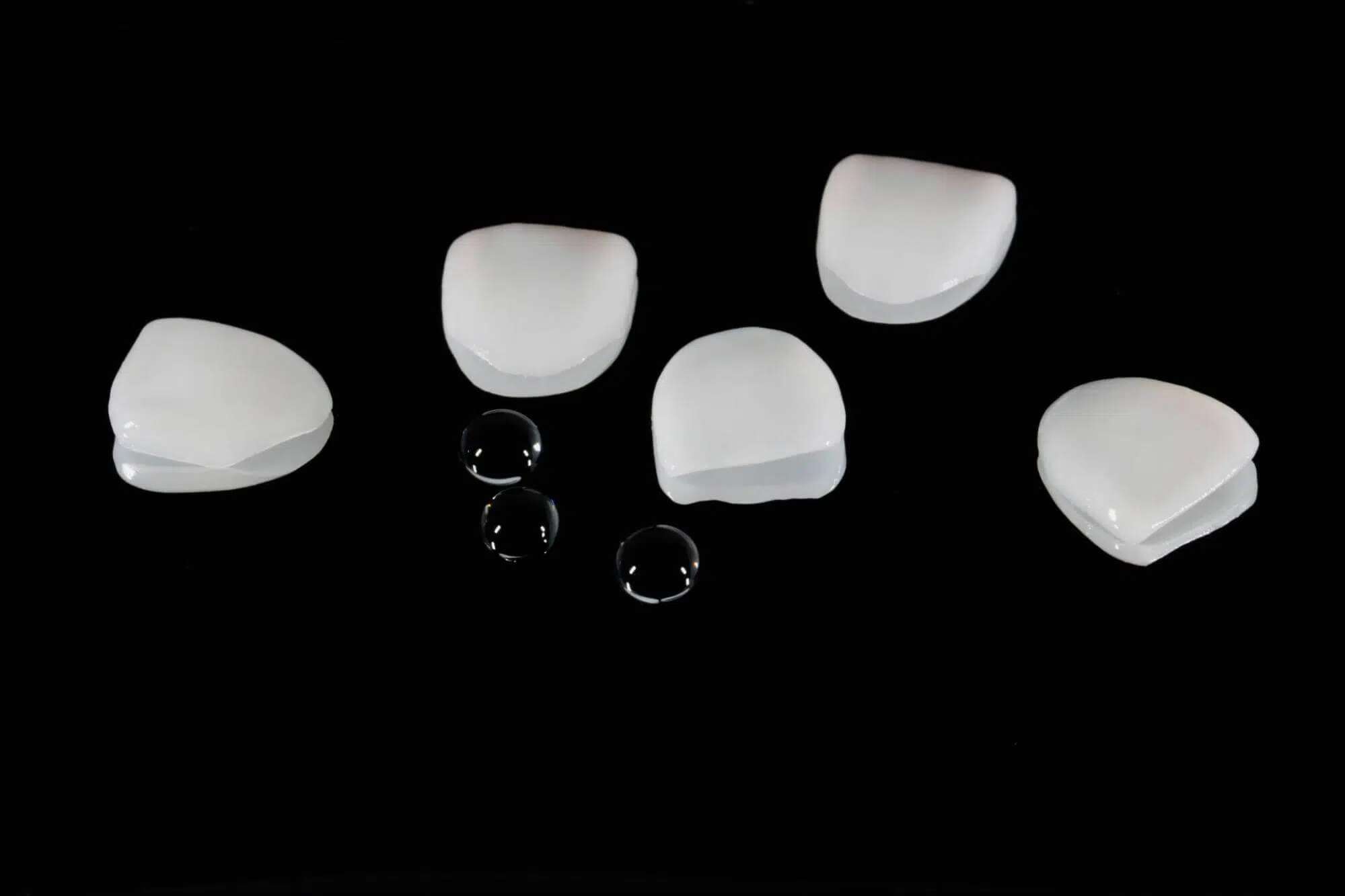 What Value Do Layered E.max Veneers Bring to Premium Smile Makeovers? 2 What Value Do Layered E.max Veneers Bring to Premium Smile Makeovers