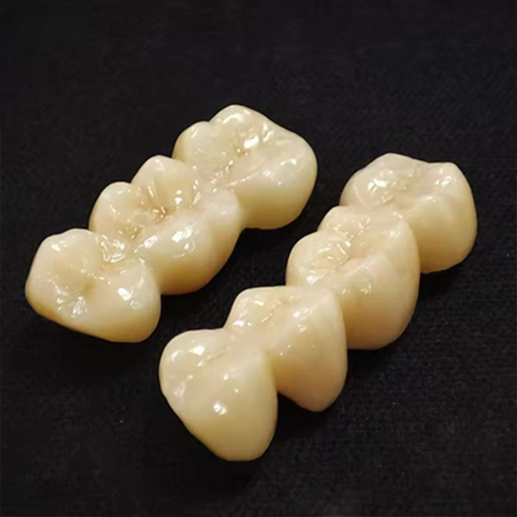 Which Smile Makeover Cases Are Better Suited to Feldspathic Rather Than E.max? 1 Which Smile Makeover Cases Are Better Suited to Feldspathic Rather Than E.max