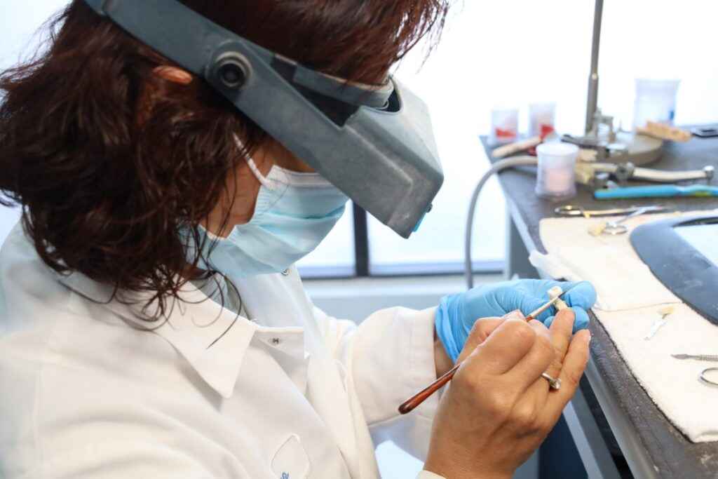 Are E.max Crowns Suitable for High-Occlusion Back Situations? 2 Are E.max Crowns Suitable for High-Occlusion Back Situations