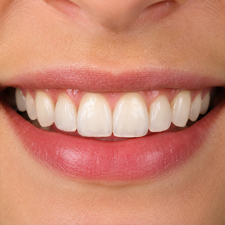 How Facial Proportions Should Guide Anterior Tooth Design 3 How Facial Proportions Should Guide Anterior Tooth Design