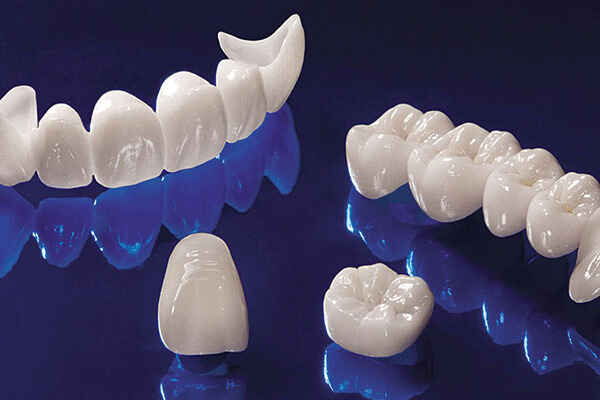 What Are the Biggest Bonding Challenges with Zirconia Veneers? 1 Zirconia Veneers