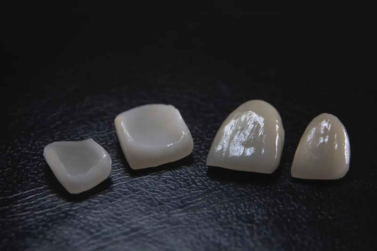 What Are the Biggest Bonding Challenges with Zirconia Veneers? 2 Zirconia Veneers