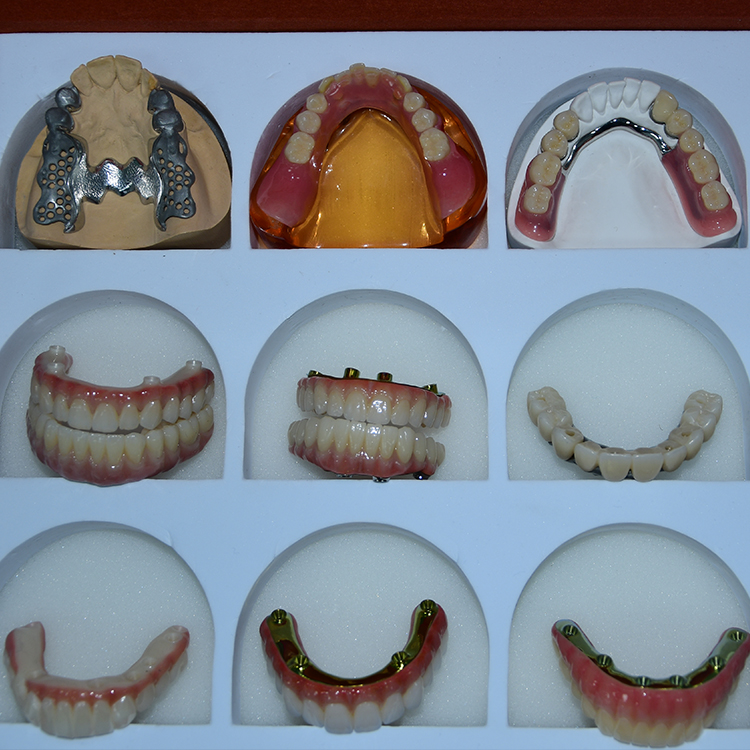 Global Delivery & After-Sales Support​