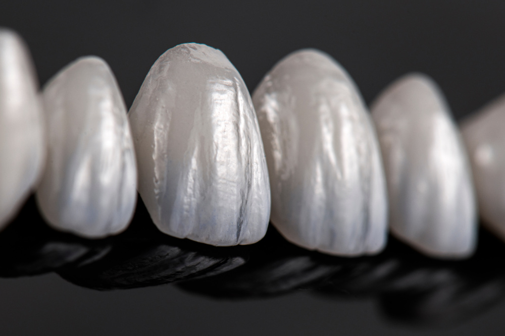 How Much Incisal Translucency Is Appropriate in Veneer Design