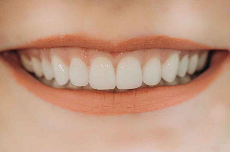 How Premium Labs Can Use Case Stories to Market High-End Anterior Restorations