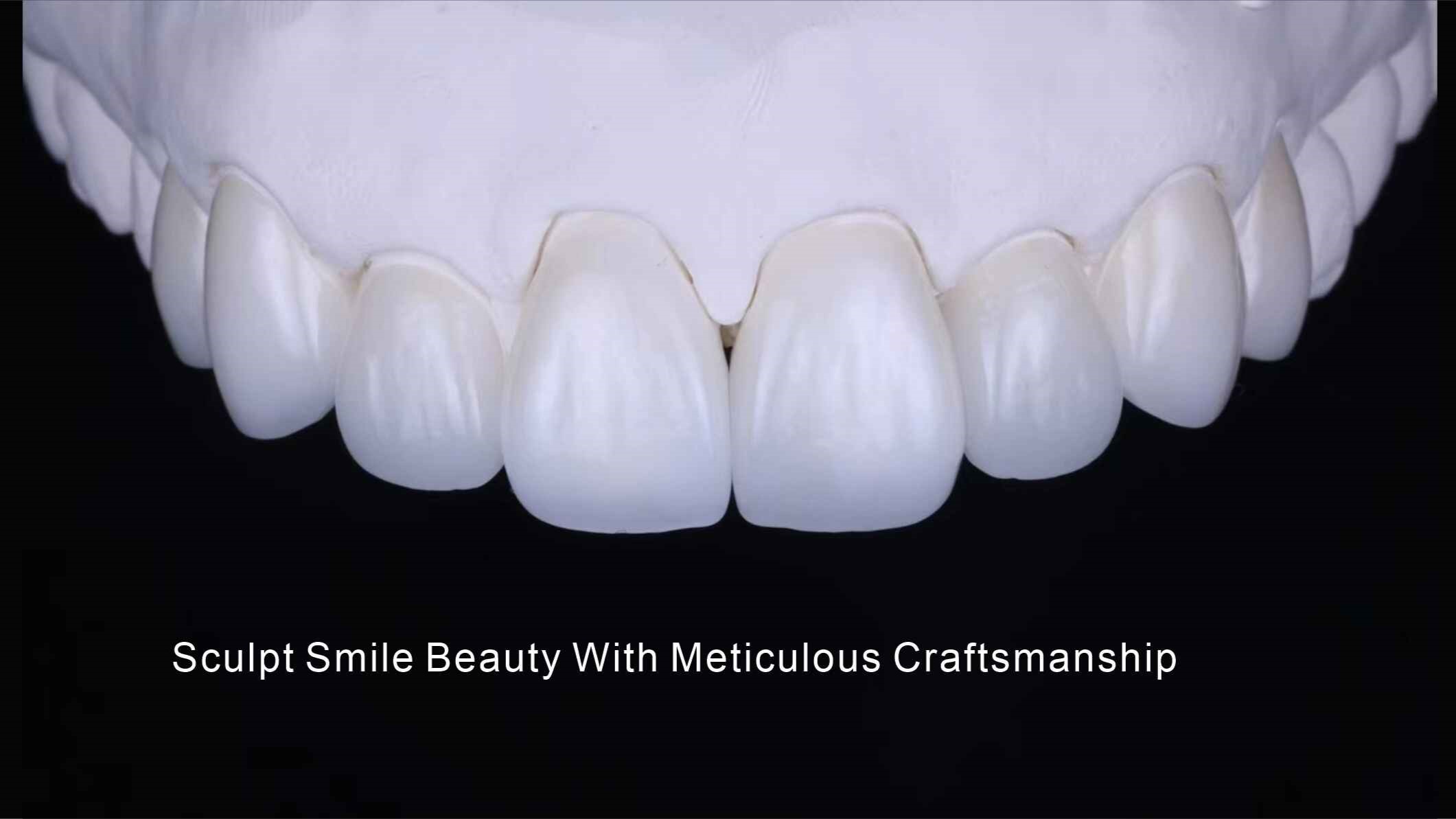 Home 13 Creare un sorriso radioso grazie a una maestria artigianale meticolosa