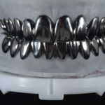 Metal veneer