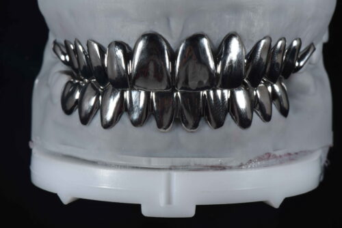Metal veneer