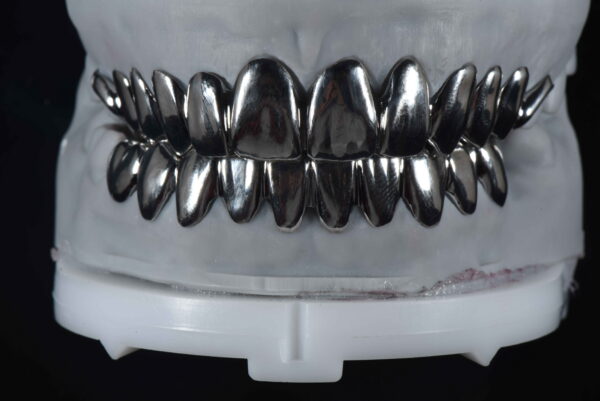 Metal veneer