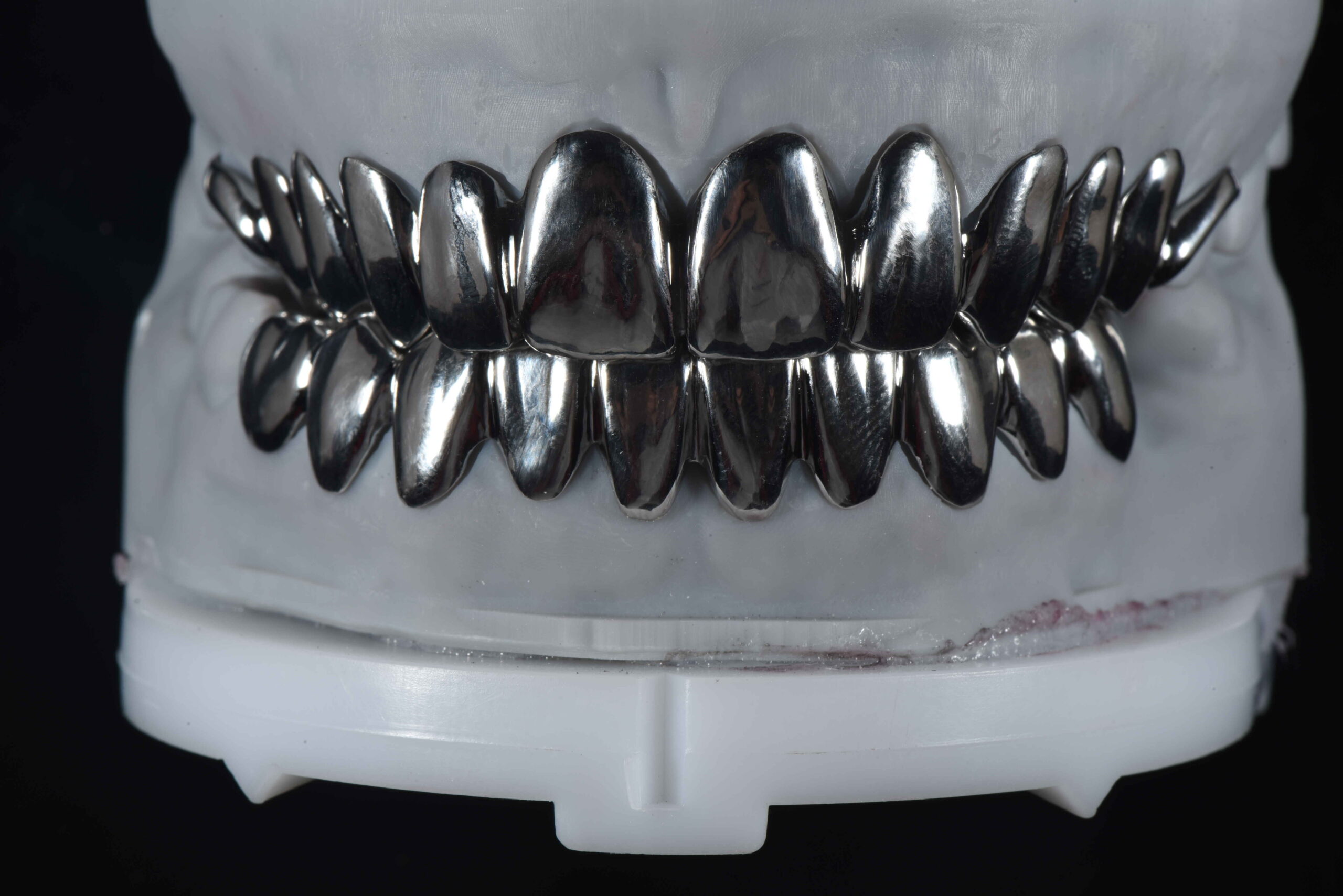 Metal veneer