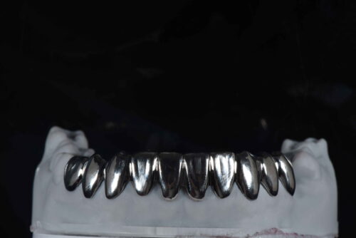 Metal veneer