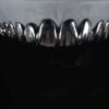 Metal veneer