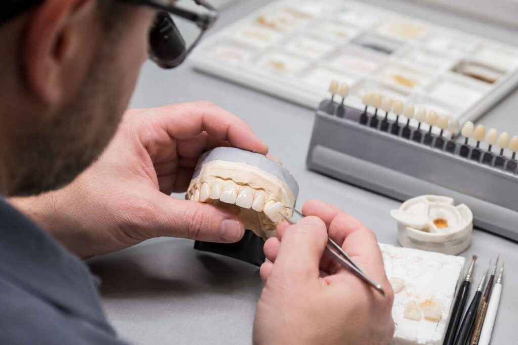 Replacing One Veneer in a Multi-Unit Case Shade and Texture Matching Strategies