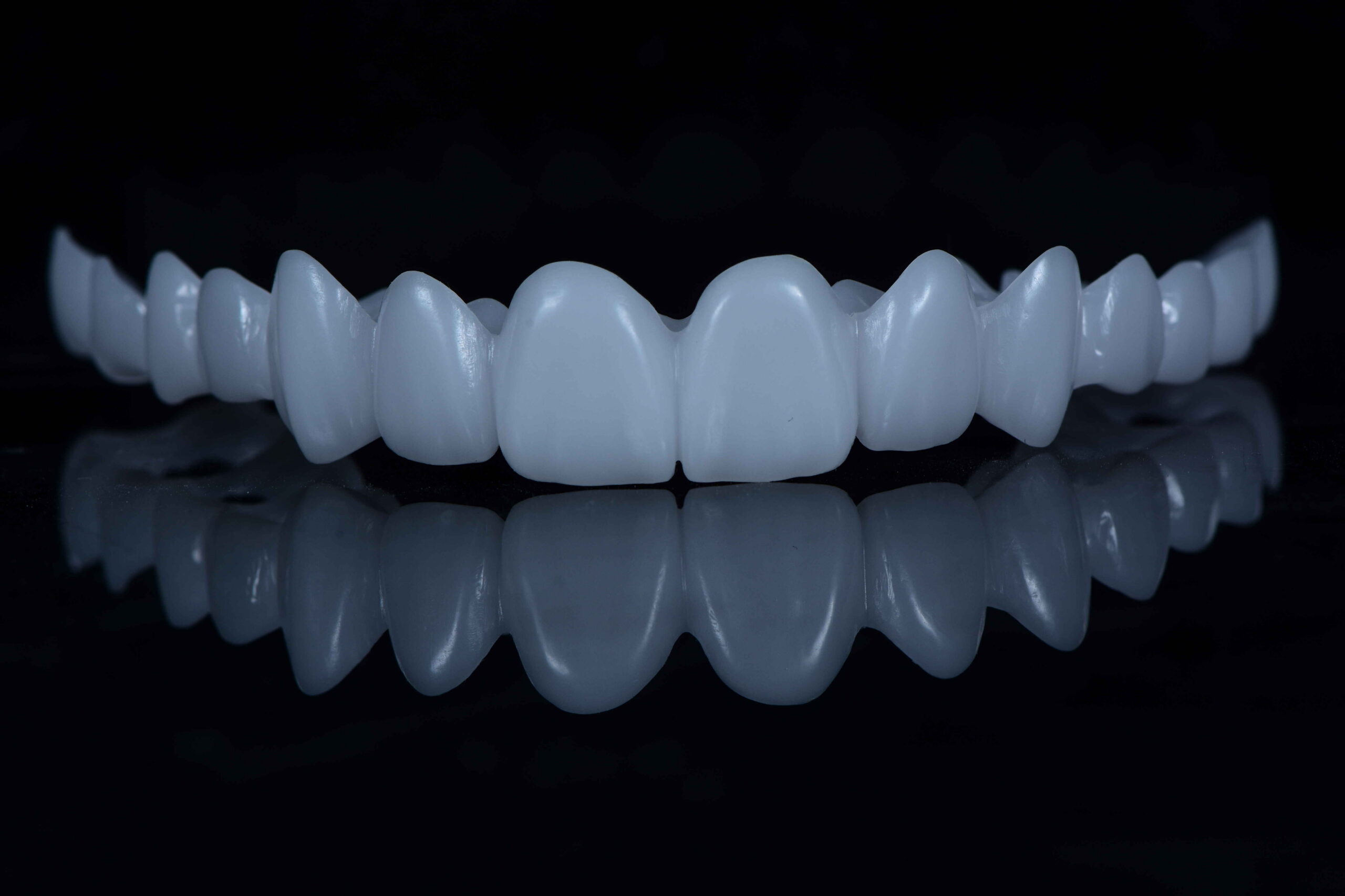 Snap on veneer