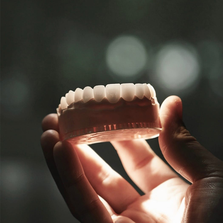 Veneers