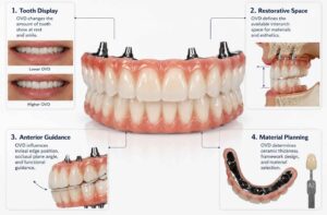 What Should Be Considered When Adjusting Vertical Dimension in Full-Mouth Esthetic Cases
