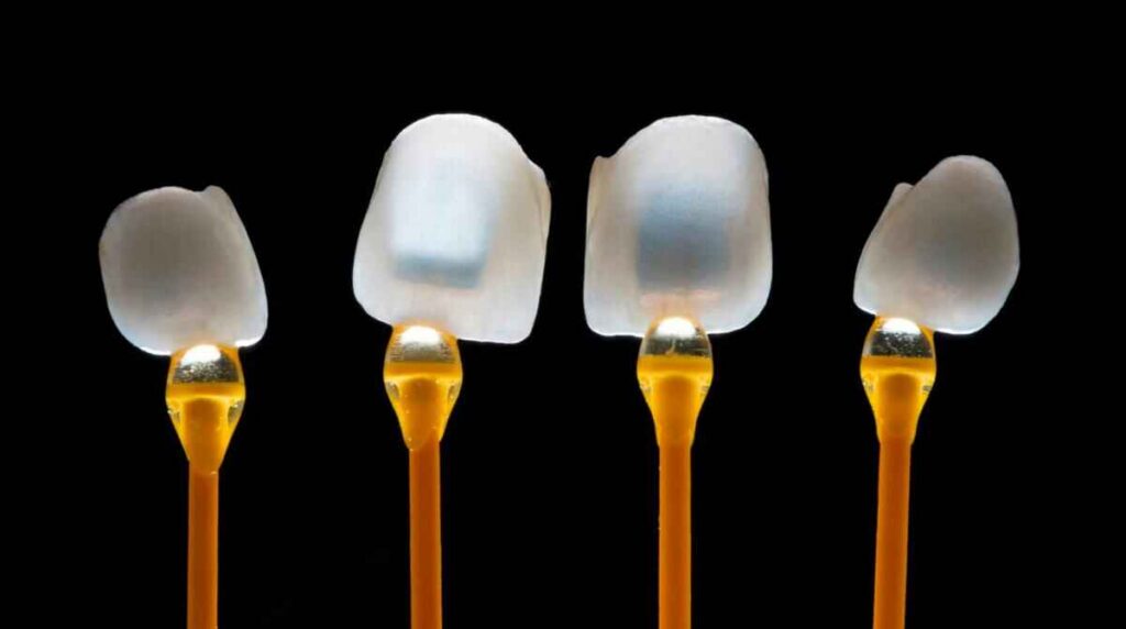 Veneer Preparation for Protrusive Teeth Managing Profile and Lip Support