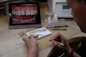 Writing a Veneer Lab Prescription for Natural Texture and Light Behavior