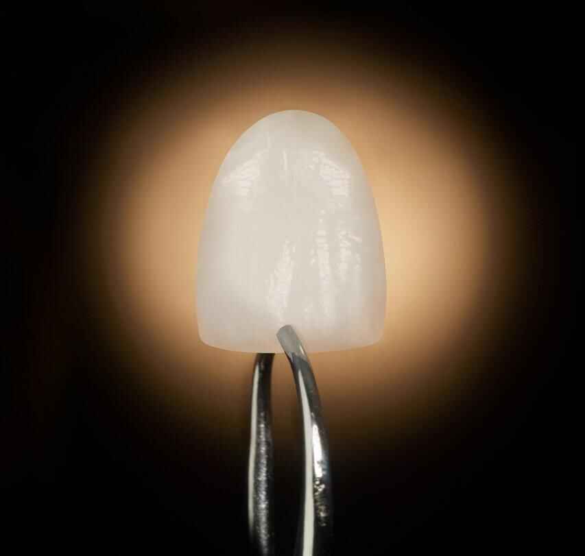 Come redigere una prescrizione per il laboratorio di faccette dentali per ottenere una texture naturale e un comportamento alla luce naturale