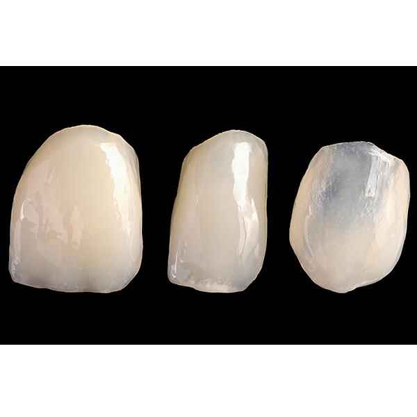 Come redigere una prescrizione per il laboratorio di faccette dentali per ottenere una texture naturale e un comportamento alla luce naturale
