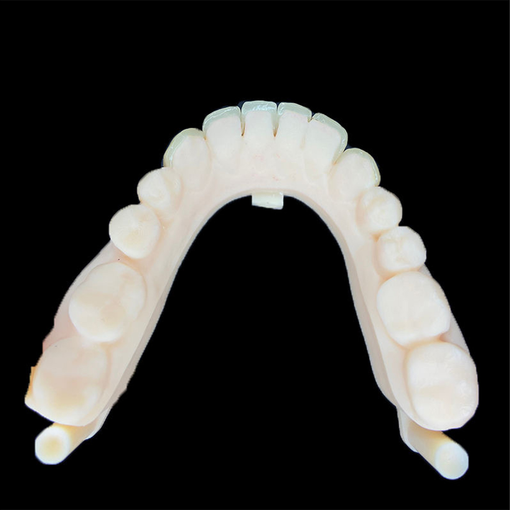 Cleaning Zirconia Veneers After Saliva-Contaminated Try-In