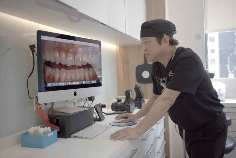 Complete Veneer Preparation Design Guide Window, Incisal Bevel, and Palatal Overlap
