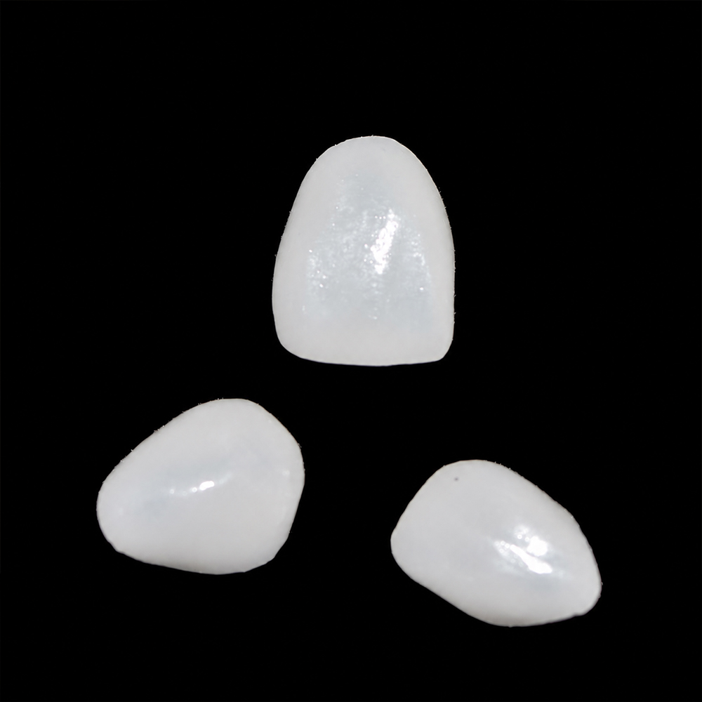E.max Veneers