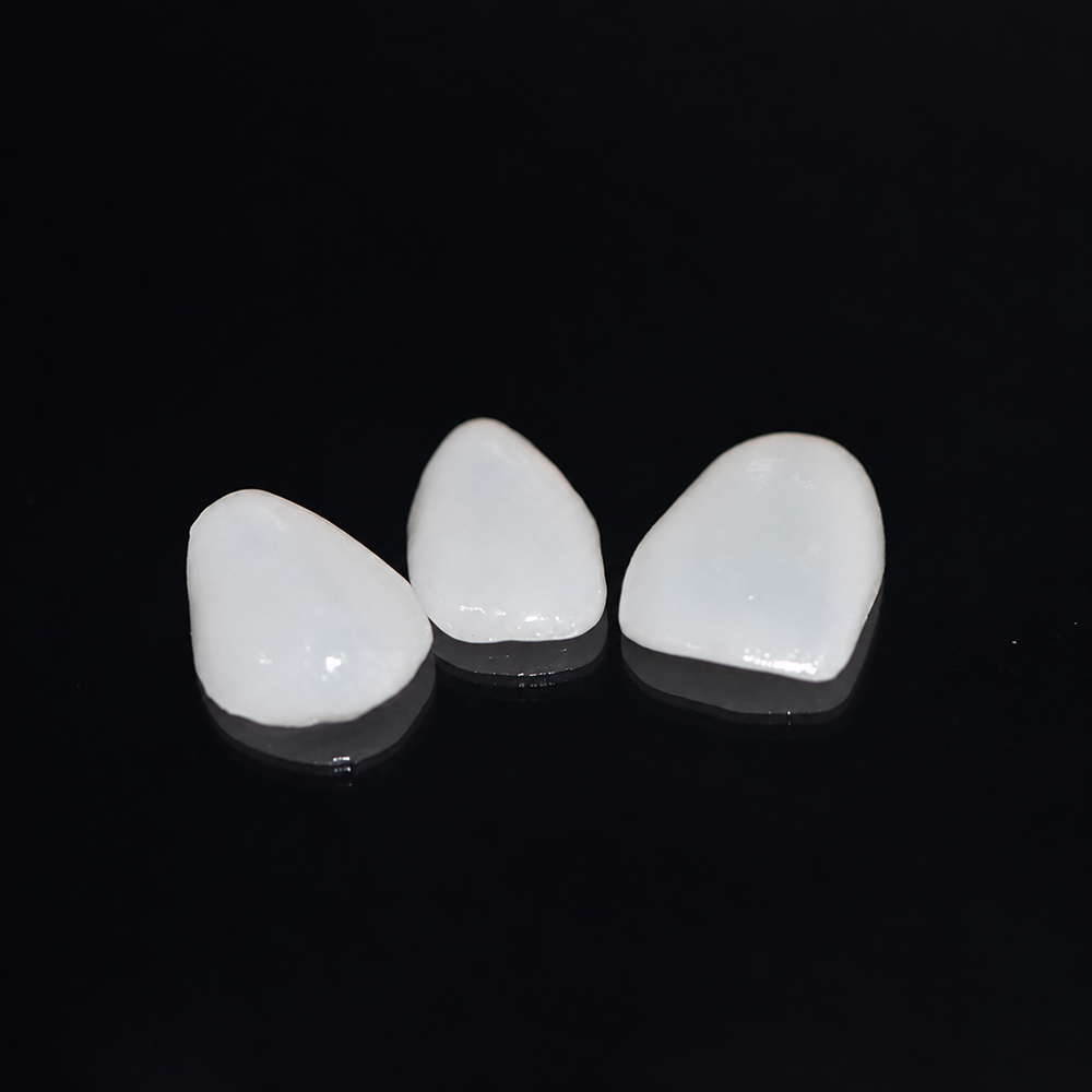 E.max Veneers
