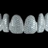 Grillz Veneer​